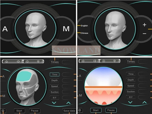 เครื่องกำจัดขนด้วยเลเซอร์ไดโอด 808nm พร้อมเซ็นเซอร์สัมผัสผิวหนัง รับประกันการกำจัดขนที่รวดเร็ว