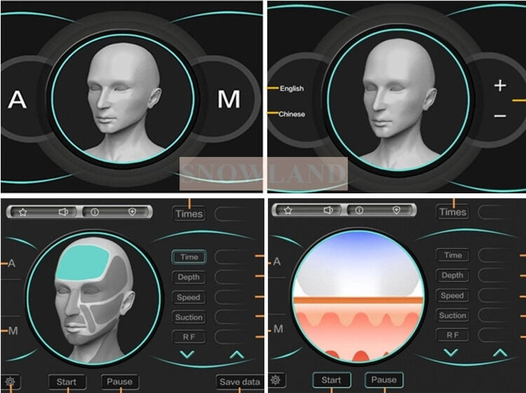 เครื่องกำจัดขนด้วยเลเซอร์ไดโอด 808nm พร้อมเซ็นเซอร์สัมผัสผิวหนัง รับประกันการกำจัดขนที่รวดเร็ว